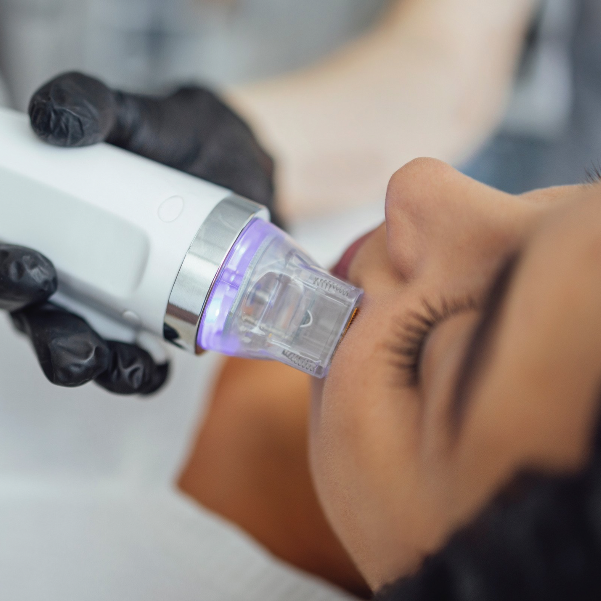 RF Microneedling Course