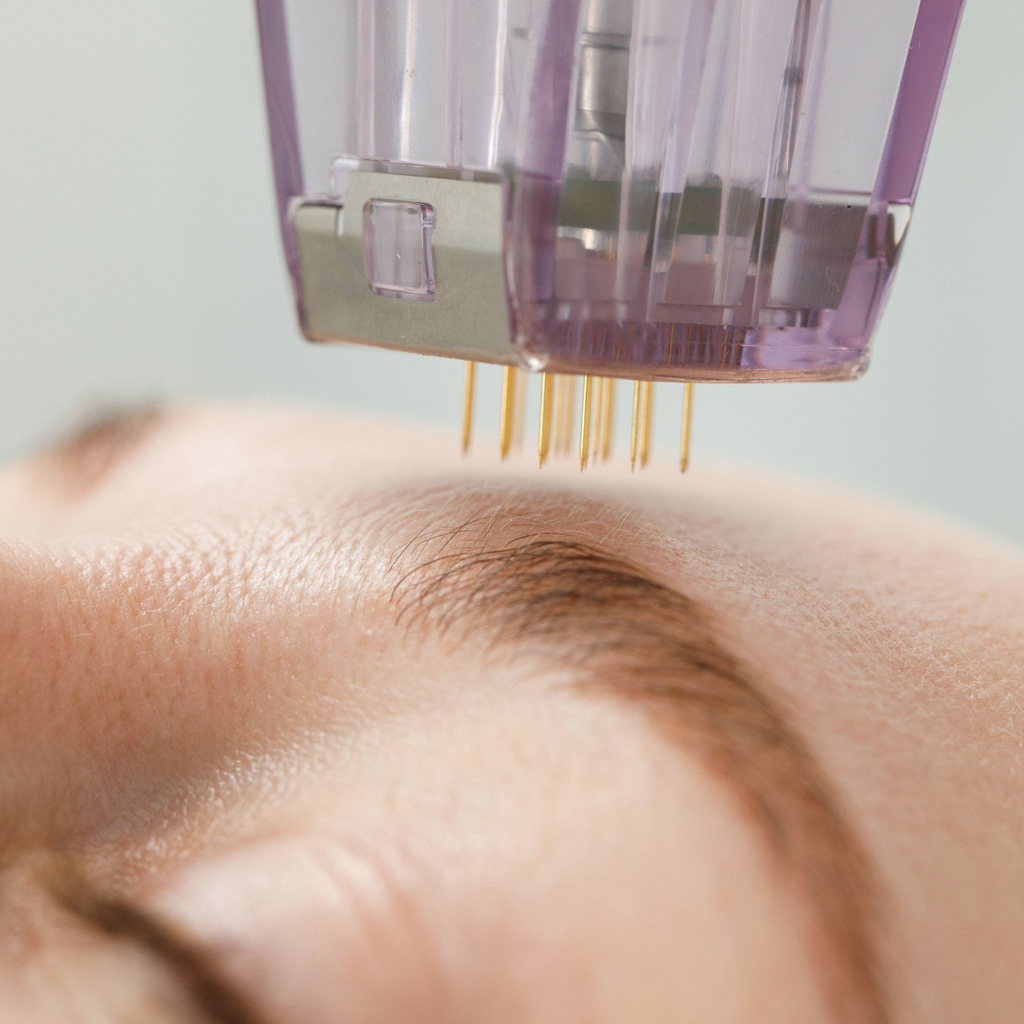 RF Microneedling Course
